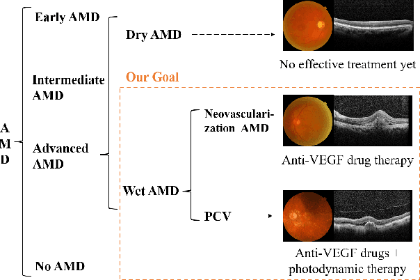 Figure 1 for KFWC: A Knowledge-Driven Deep Learning Model for Fine-grained Classification of Wet-AMD
