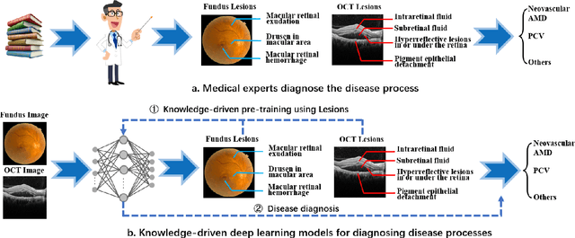 Figure 3 for KFWC: A Knowledge-Driven Deep Learning Model for Fine-grained Classification of Wet-AMD