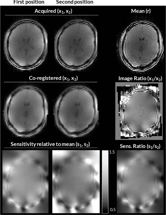 Figure 1 for Correcting inter-scan motion artefacts in quantitative R1 mapping at 7T