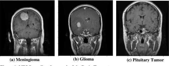 Figure 1 for HSADML: Hyper-Sphere Angular Deep Metric based Learning for Brain Tumor Classification