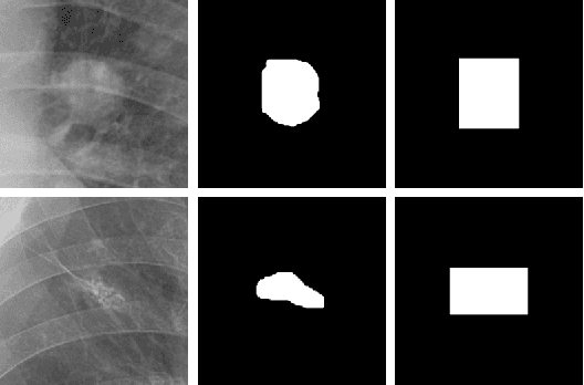 Figure 1 for Image Synthesis with Disentangled Attributes for Chest X-Ray Nodule Augmentation and Detection