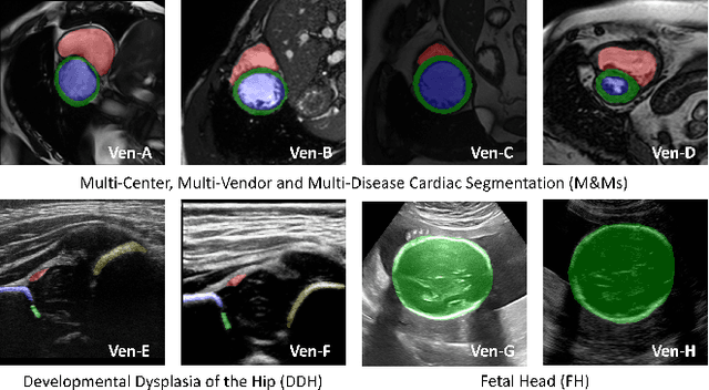 Figure 1 for Online Reflective Learning for Robust Medical Image Segmentation