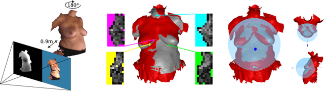 Figure 1 for A comparative study of breast surface reconstruction for aesthetic outcome assessment