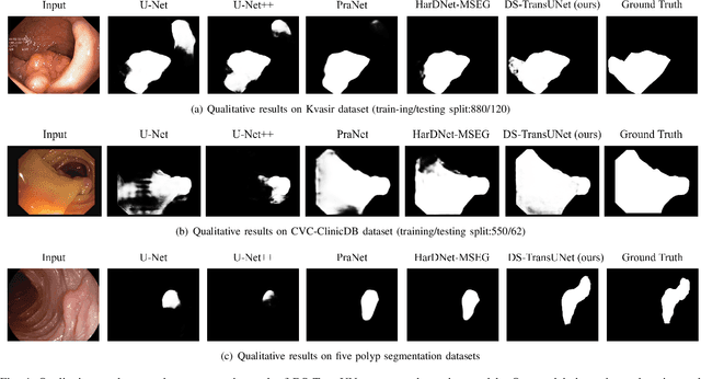 Figure 4 for DS-TransUNet:Dual Swin Transformer U-Net for Medical Image Segmentation