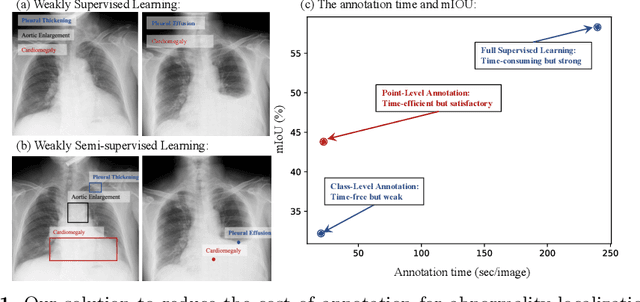 Figure 1 for A Benchmark for Weakly Semi-Supervised Abnormality Localization in Chest X-Rays