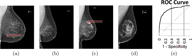 Figure 3 for Large-scale mammography CAD with Deformable Conv-Nets