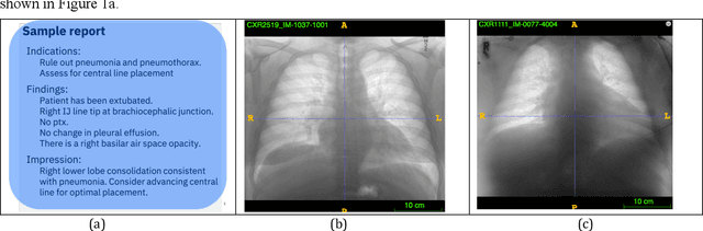 Figure 1 for Extracting and Learning Fine-Grained Labels from Chest Radiographs
