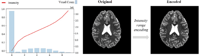 Figure 3 for Implicit field learning for unsupervised anomaly detection in medical images