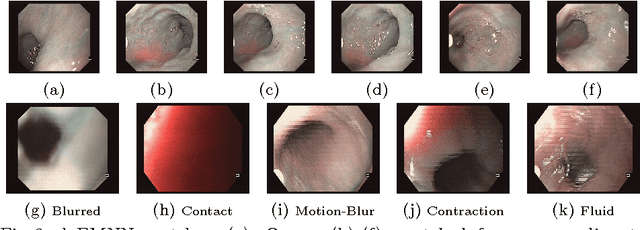 Figure 3 for Automatic View-Point Selection for Inter-Operative Endoscopic Surveillance