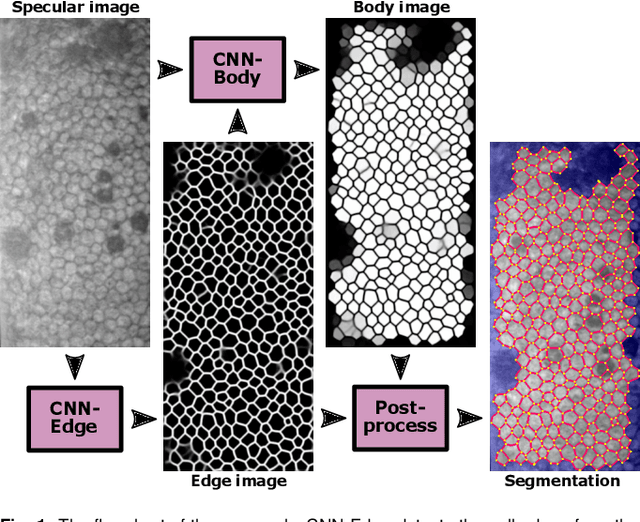 Figure 1 for DenseUNets with feedback non-local attention for the segmentation of specular microscopy images of the corneal endothelium with guttae