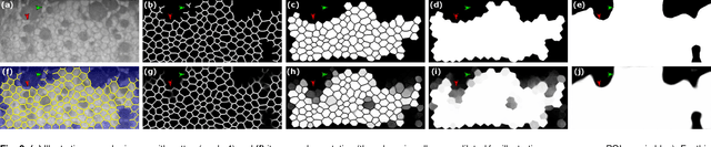 Figure 3 for DenseUNets with feedback non-local attention for the segmentation of specular microscopy images of the corneal endothelium with guttae