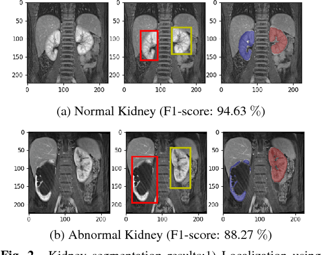 Figure 3 for Automatic Renal Segmentation in DCE-MRI using Convolutional Neural Networks