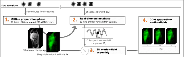 Figure 1 for Real-time non-rigid 3D respiratory motion estimation for MR-guided radiotherapy using MR-MOTUS