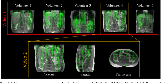 Figure 3 for Real-time non-rigid 3D respiratory motion estimation for MR-guided radiotherapy using MR-MOTUS