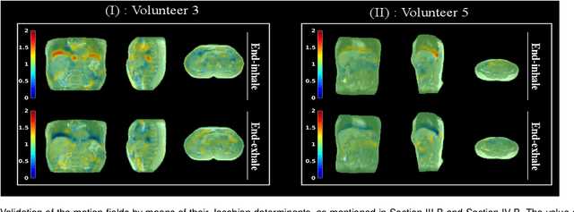 Figure 4 for Real-time non-rigid 3D respiratory motion estimation for MR-guided radiotherapy using MR-MOTUS