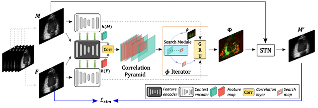 Figure 1 for SearchMorph:Multi-scale Correlation Iterative Network for Deformable Registration