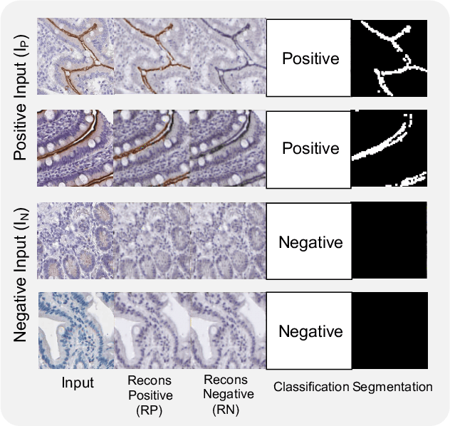 Figure 4 for CaCL: Class-aware Codebook Learning for Weakly Supervised Segmentation on Diffuse Image Patterns