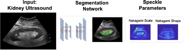 Figure 1 for The Kidneys Are Not All Normal: Investigating the Speckle Distributions of Transplanted Kidneys