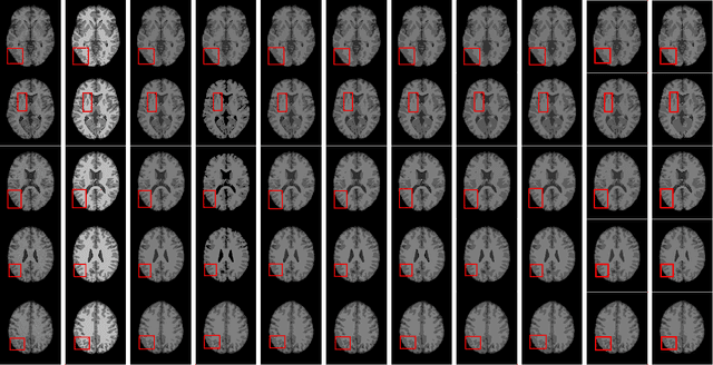 Figure 2 for Kullback-Leibler Divergence-Based Fuzzy $C$-Means Clustering Incorporating Morphological Reconstruction and Wavelet Frames for Image Segmentation