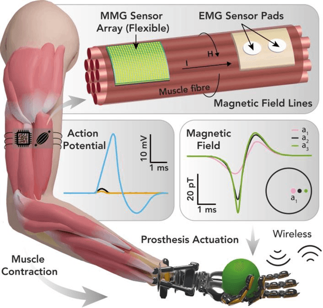 Figure 1 for Modelling and Analysis of Magnetic Fields from Skeletal Muscle for Valuable Physiological Measurements