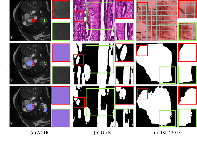 Figure 1 for C2FTrans: Coarse-to-Fine Transformers for Medical Image Segmentation
