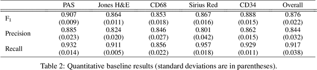 Figure 4 for Towards Histopathological Stain Invariance by Unsupervised Domain Augmentation using Generative Adversarial Networks