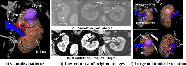 Figure 1 for EnMcGAN: Adversarial Ensemble Learning for 3D Complete Renal Structures Segmentation