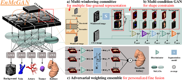 Figure 3 for EnMcGAN: Adversarial Ensemble Learning for 3D Complete Renal Structures Segmentation