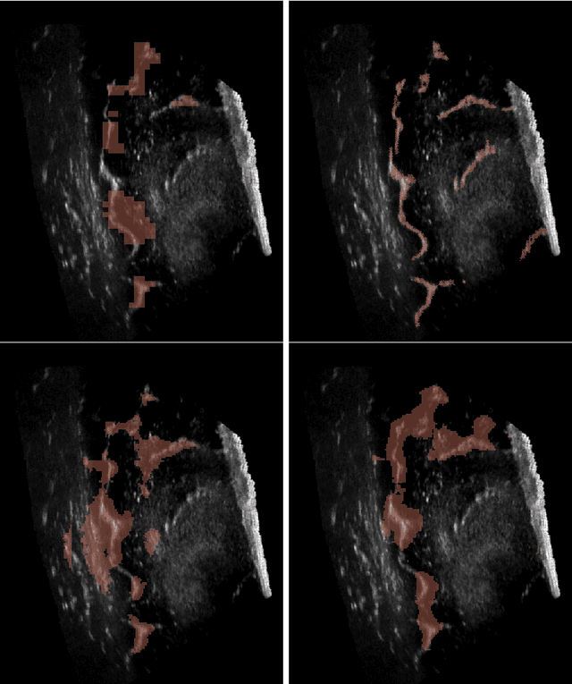 Figure 1 for Fully Automatic Segmentation of 3D Brain Ultrasound: Learning from Coarse Annotations