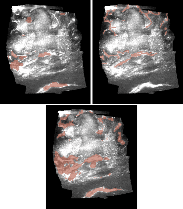 Figure 4 for Fully Automatic Segmentation of 3D Brain Ultrasound: Learning from Coarse Annotations