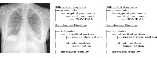 Figure 1 for UMLS-ChestNet: A deep convolutional neural network for radiological findings, differential diagnoses and localizations of COVID-19 in chest x-rays