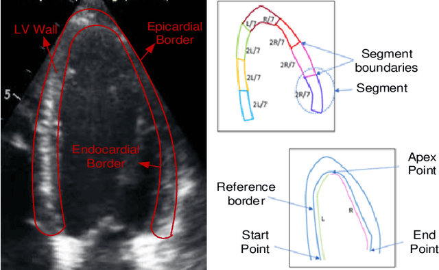 Figure 2 for Left Ventricular Wall Motion Estimation by Active Polynomials for Acute Myocardial Infarction Detection
