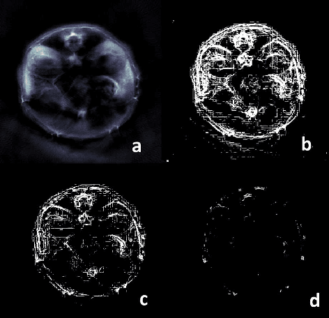 Figure 1 for Multiscale edge detection and parametric shape modeling for boundary delineation in optoacoustic images