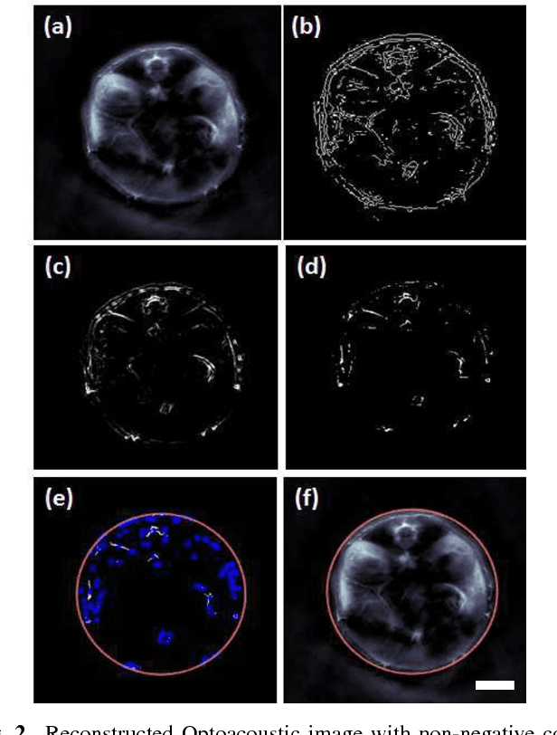 Figure 3 for Multiscale edge detection and parametric shape modeling for boundary delineation in optoacoustic images