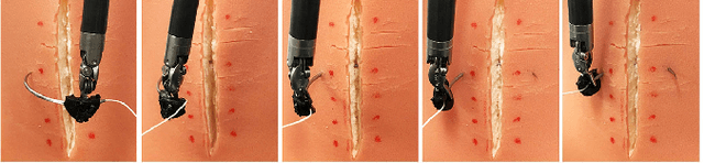 Figure 2 for Optimal Needle Diameter, Shape, and Path in Autonomous Suturing