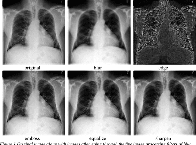 Figure 1 for Convolutional neural networks model improvements using demographics and image processing filters on chest x-rays