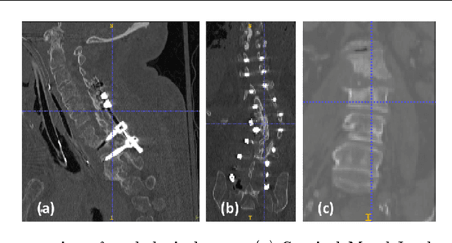 Figure 1 for Automatic Vertebra Labeling in Large-Scale 3D CT using Deep Image-to-Image Network with Message Passing and Sparsity Regularization