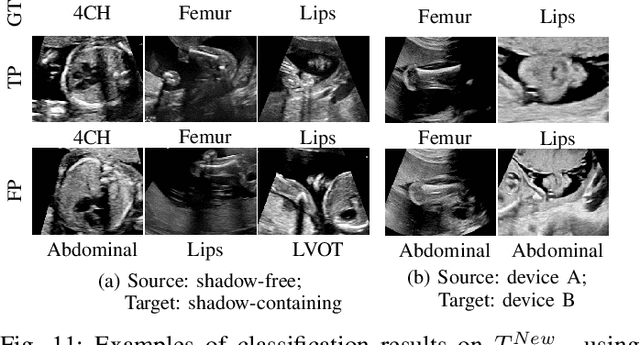 Figure 3 for Mutual Information-based Disentangled Neural Networks for Classifying Unseen Categories in Different Domains: Application to Fetal Ultrasound Imaging