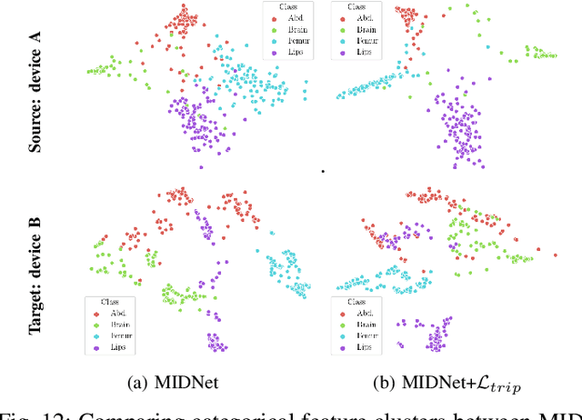 Figure 4 for Mutual Information-based Disentangled Neural Networks for Classifying Unseen Categories in Different Domains: Application to Fetal Ultrasound Imaging