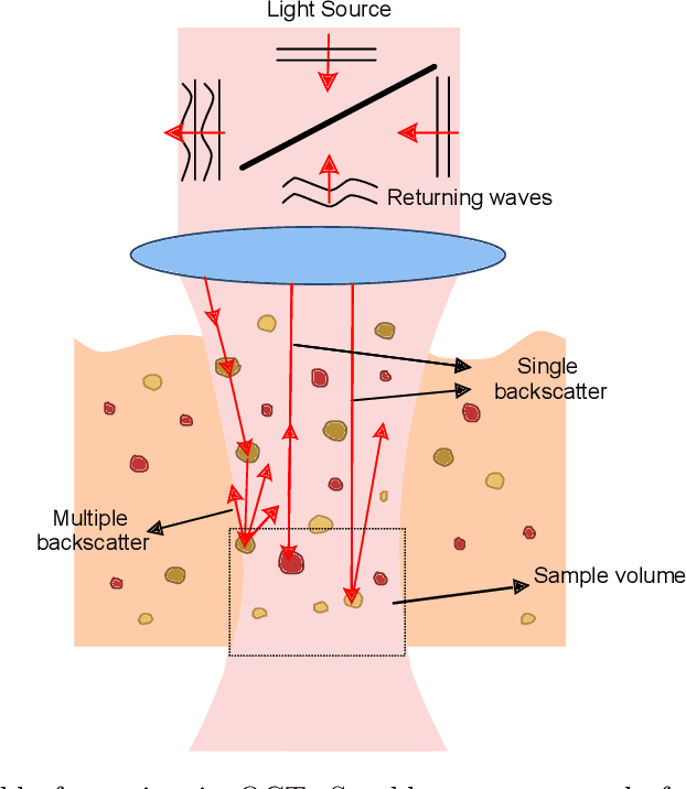 Figure 1 for Signal-carrying speckle in Optical Coherence Tomography: a methodological review on biomedical applications