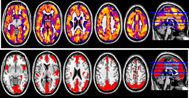 Figure 1 for Randomized Structural Sparsity based Support Identification with Applications to Locating Activated or Discriminative Brain Areas: A Multi-center Reproducibility Study