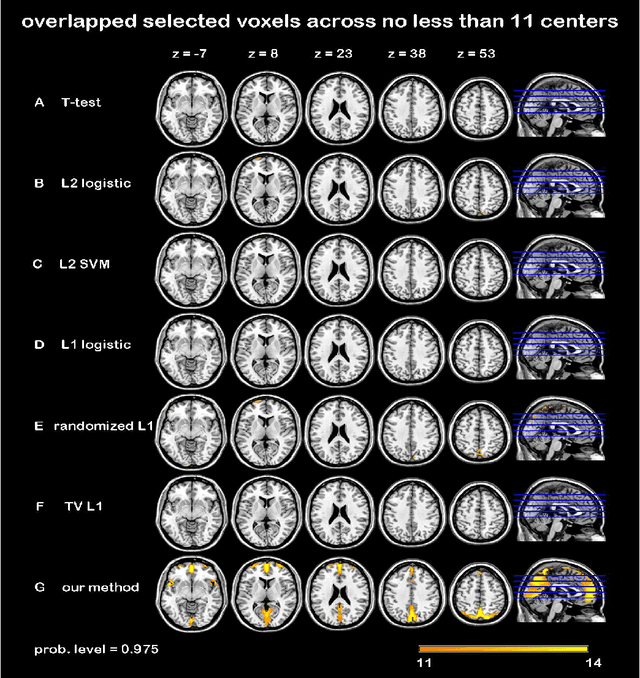 Figure 3 for Randomized Structural Sparsity based Support Identification with Applications to Locating Activated or Discriminative Brain Areas: A Multi-center Reproducibility Study