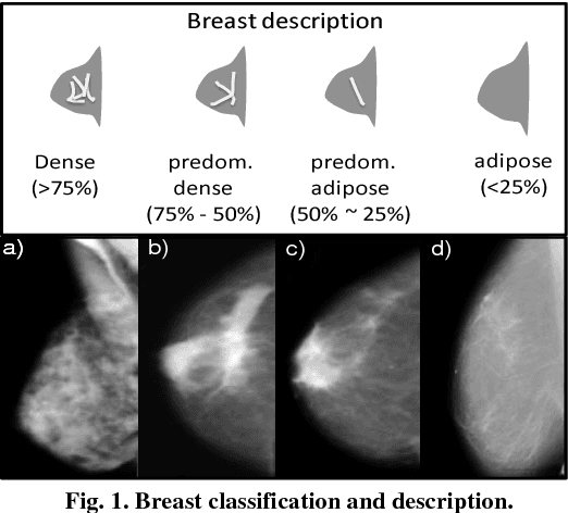 Figure 2 for Detection and classification of masses in mammographic images in a multi-kernel approach