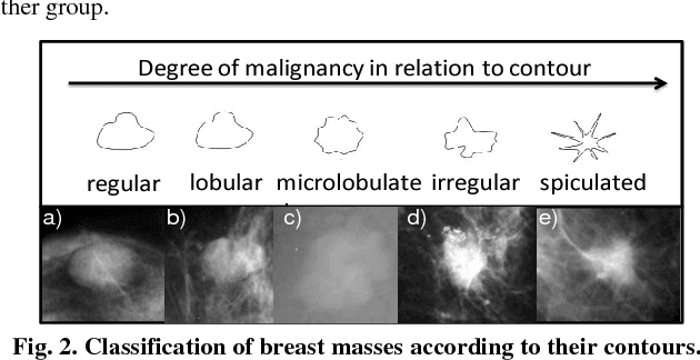 Figure 3 for Detection and classification of masses in mammographic images in a multi-kernel approach