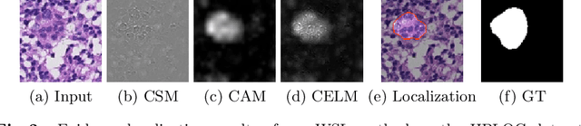 Figure 4 for CELNet: Evidence Localization for Pathology Images using Weakly Supervised Learning