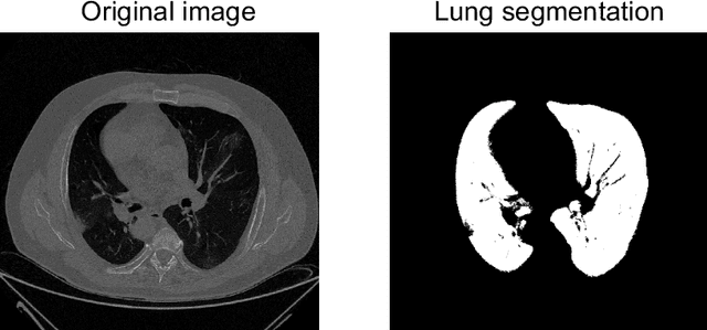 Figure 3 for Probabilistic combination of eigenlungs-based classifiers for COVID-19 diagnosis in chest CT images