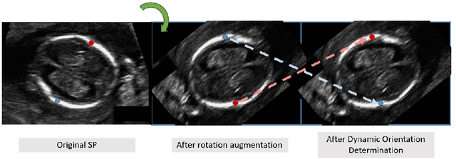 Figure 3 for BiometryNet: Landmark-based Fetal Biometry Estimation from Standard Ultrasound Planes