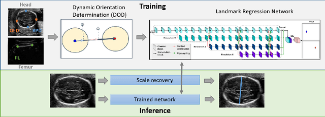 Figure 4 for BiometryNet: Landmark-based Fetal Biometry Estimation from Standard Ultrasound Planes