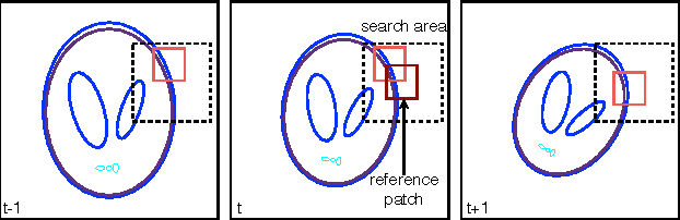 Figure 3 for Depth Superresolution using Motion Adaptive Regularization