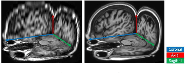 Figure 1 for Deep Slice Interpolation via Marginal Super-Resolution, Fusion and Refinement